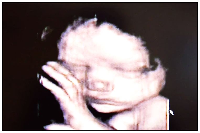 ultrasound of unborn baby